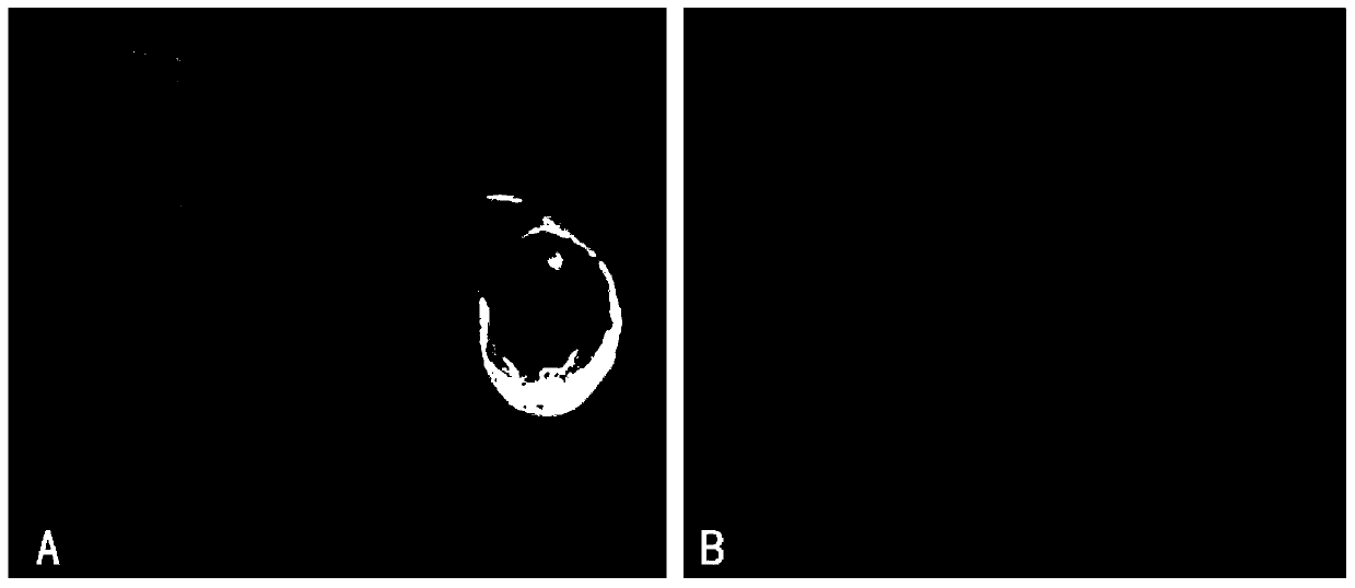 A method for constructing segmental individualized three-dimensional scaffold material for human urethra