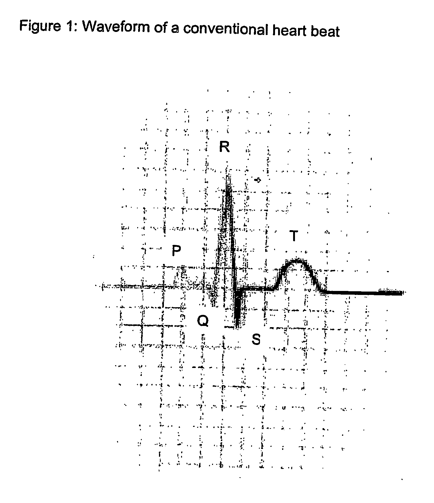 Instantaneous Autonomic Nervous Function and Cardiac Predictability Based on Heart and Pulse Rate Variability Analysis