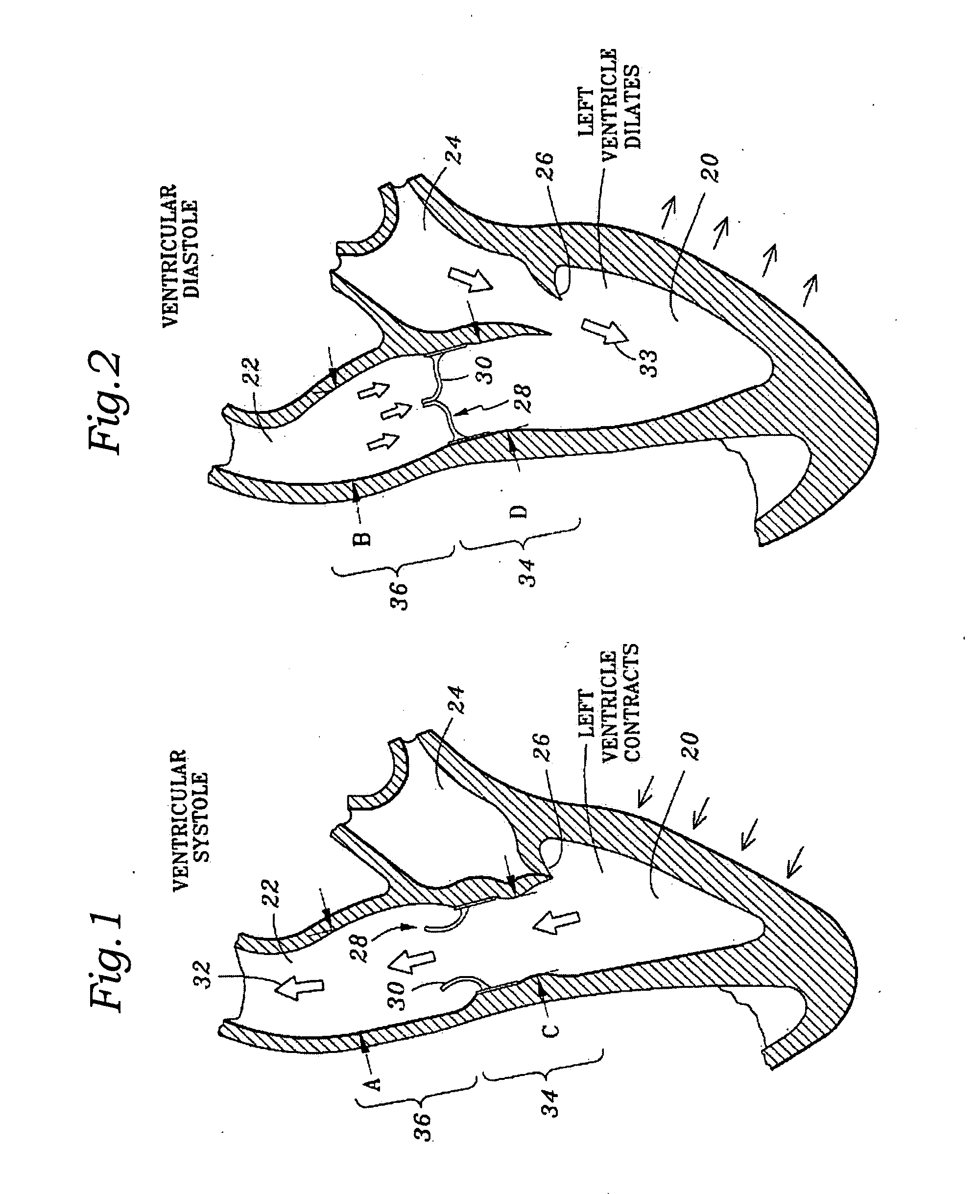 Stress absorbing flexible heart valve frame