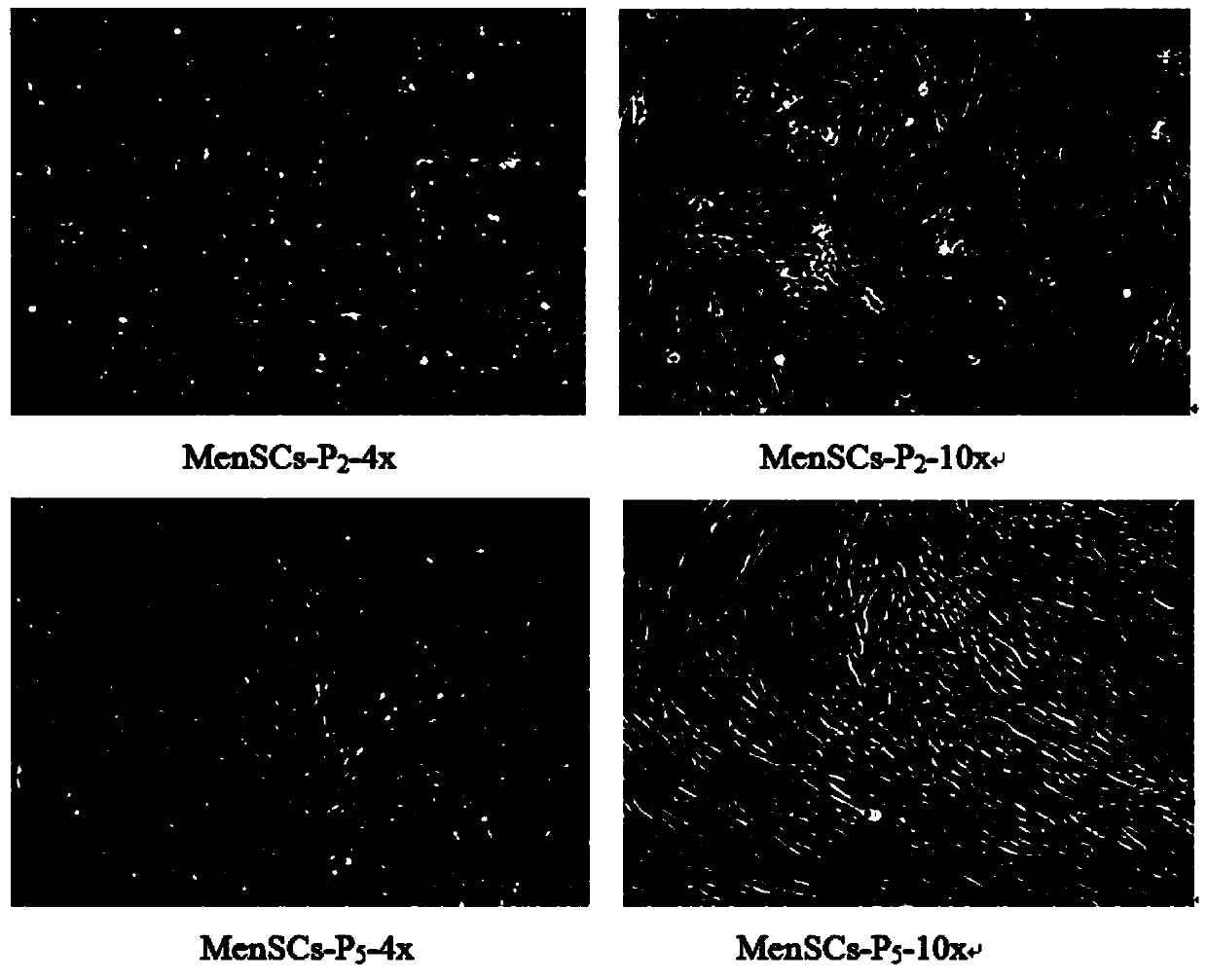 Thermo-sensitive gelatin preparation for endometrium stem cells and preparation method and application of thermo-sensitive gelatin preparation