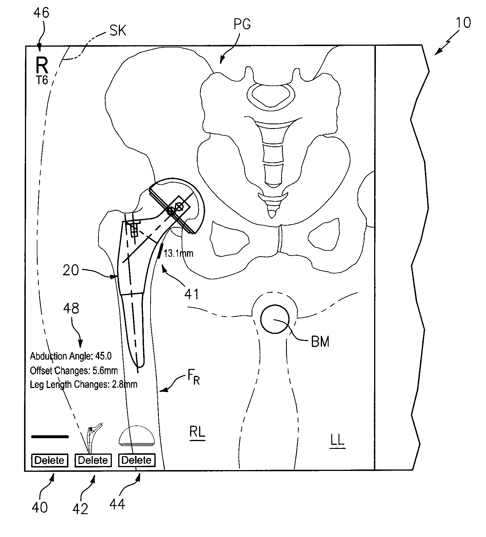 Systems and Methods for Intra-Operative Image Analysis