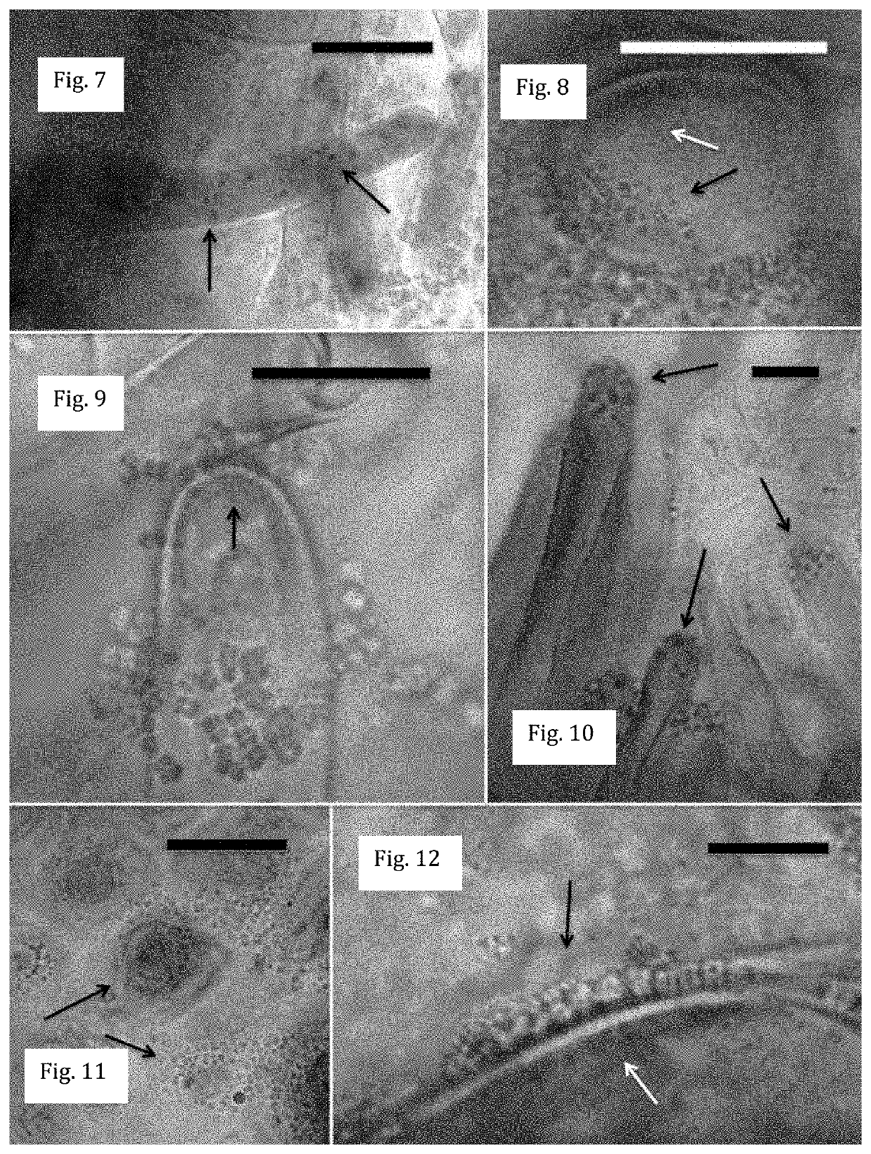 Endophytic microbes for growth promotion of crop plants and suppression of aggressive invasive plant species