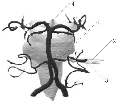 Facial spasm model based on MR images and preparation method thereof