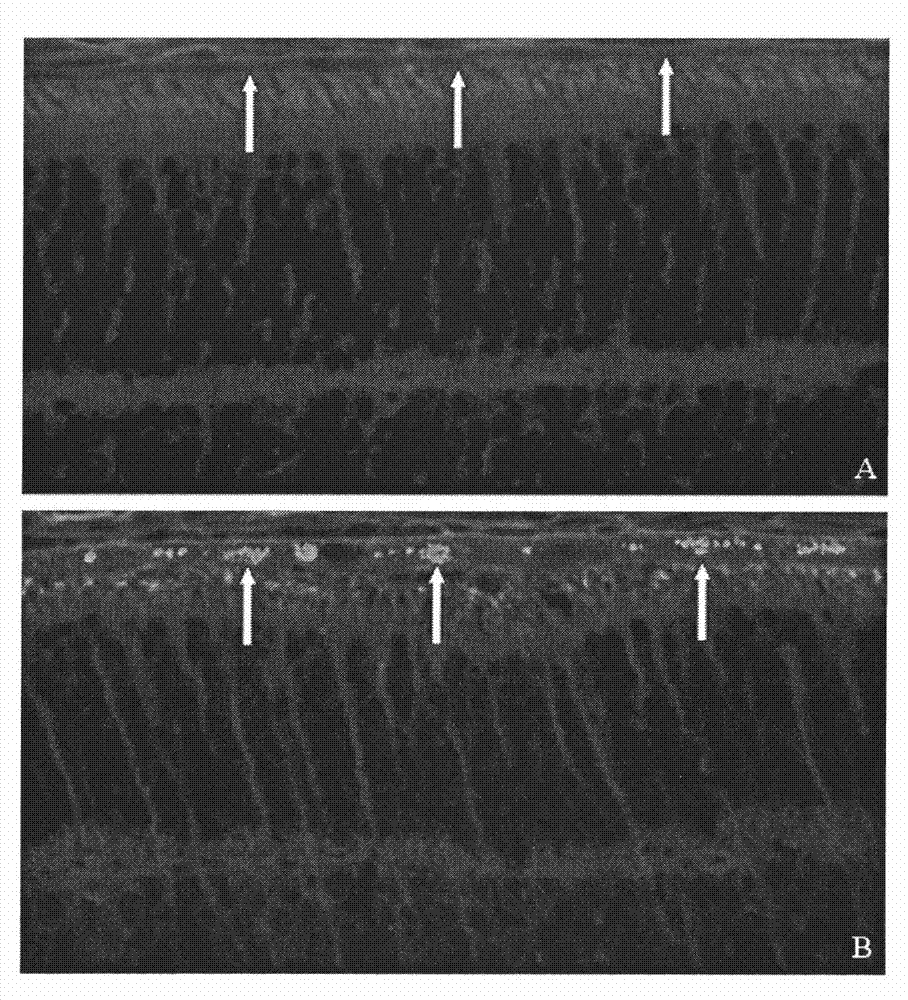 Method and device for assisting in gene transfer by utilizing electroporation