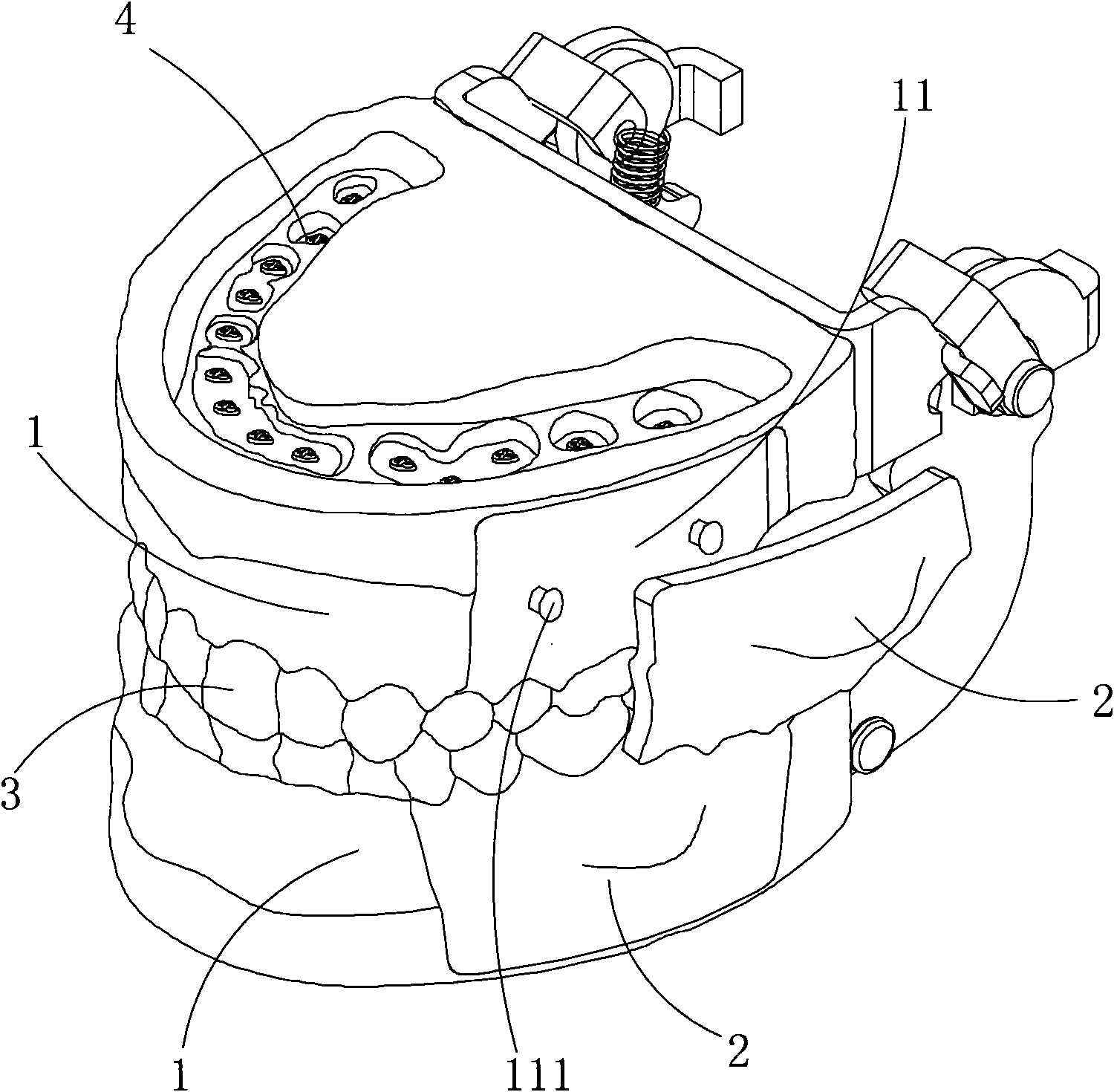 Alveolar abscess cut model