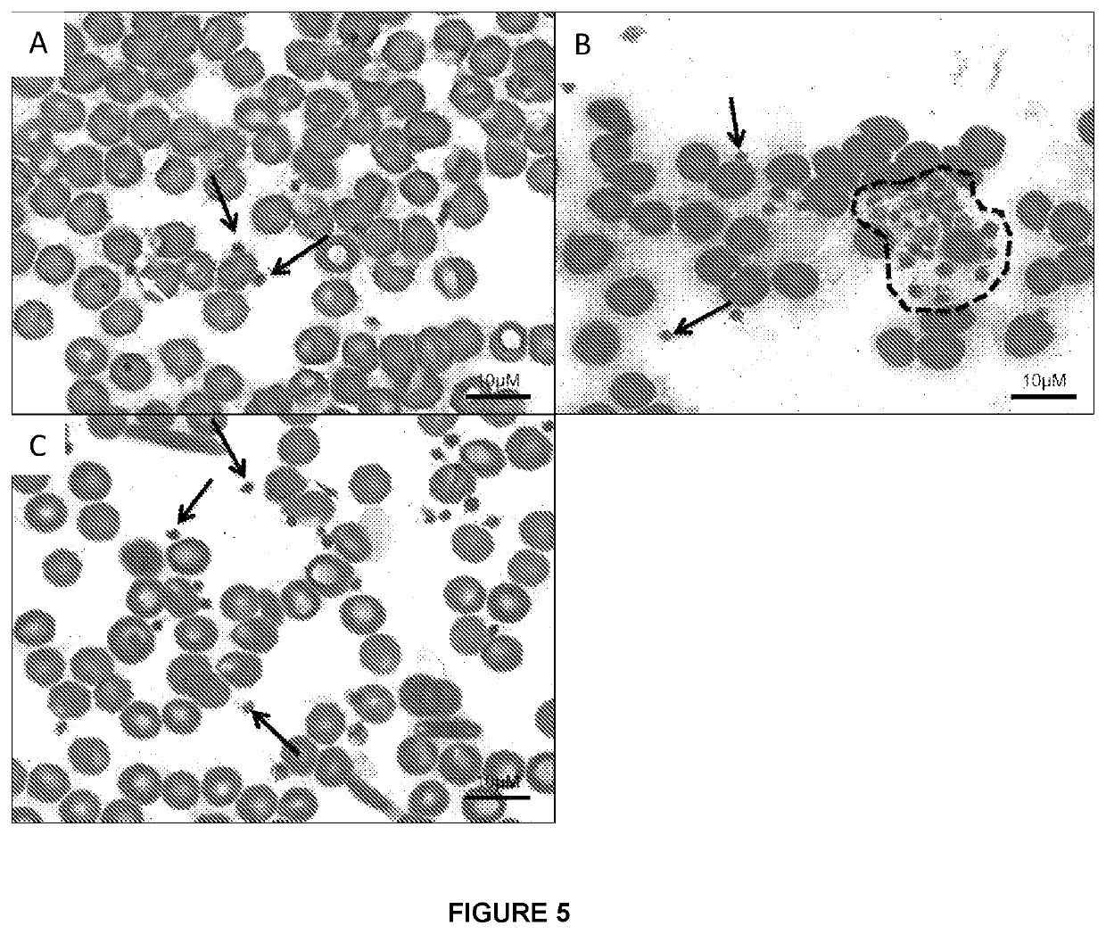 Use of serotonergic drugs to treat virus-induced thrombocytopenia