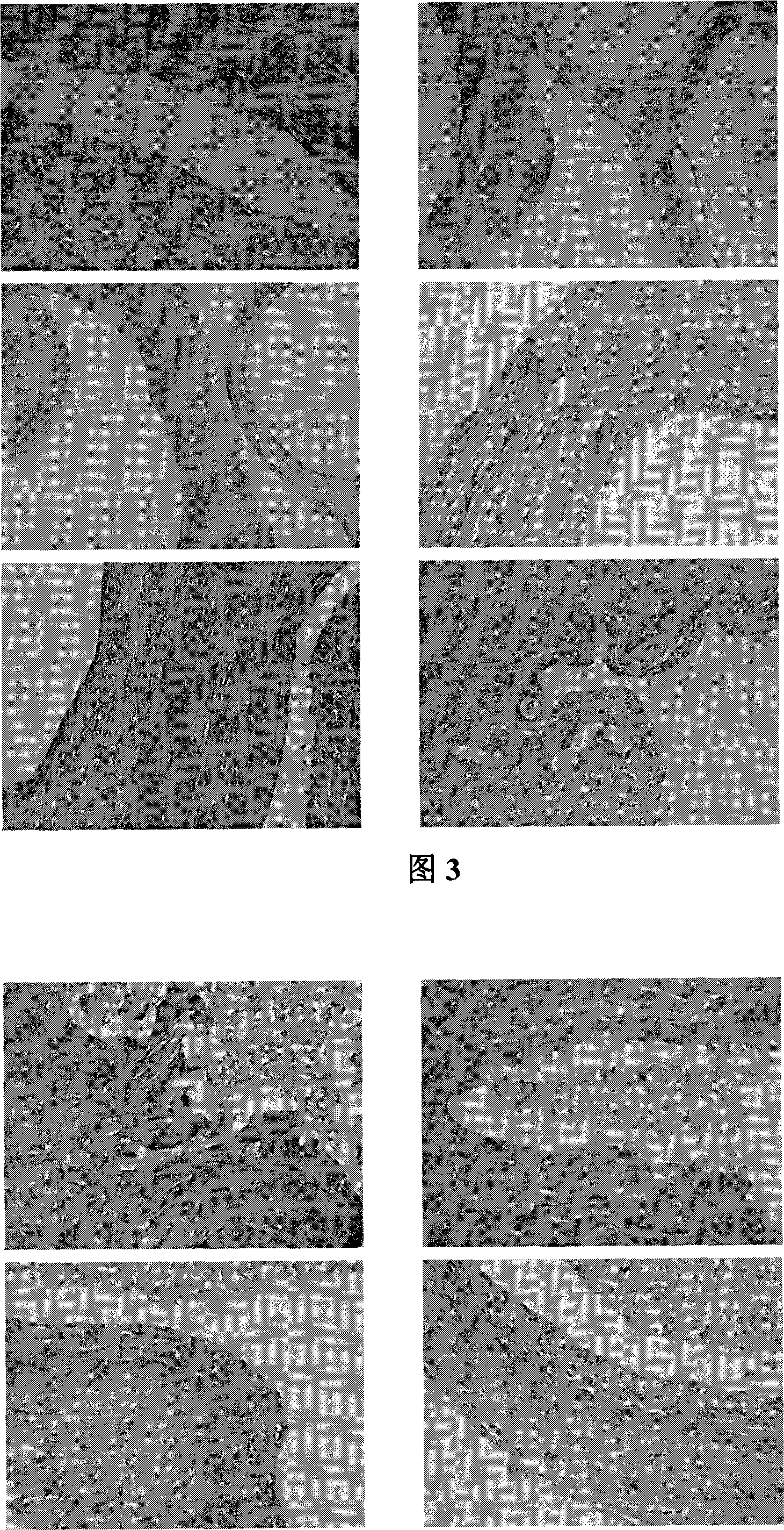 Traditional Chinese medicinal composition for preparing medicine for preventing and treating gynopathy