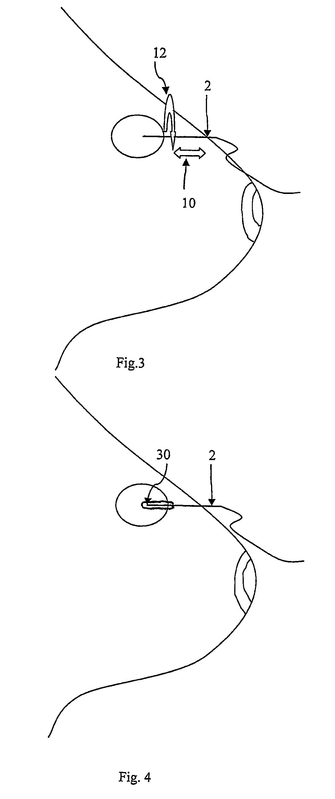 Arrangement for cell sampling