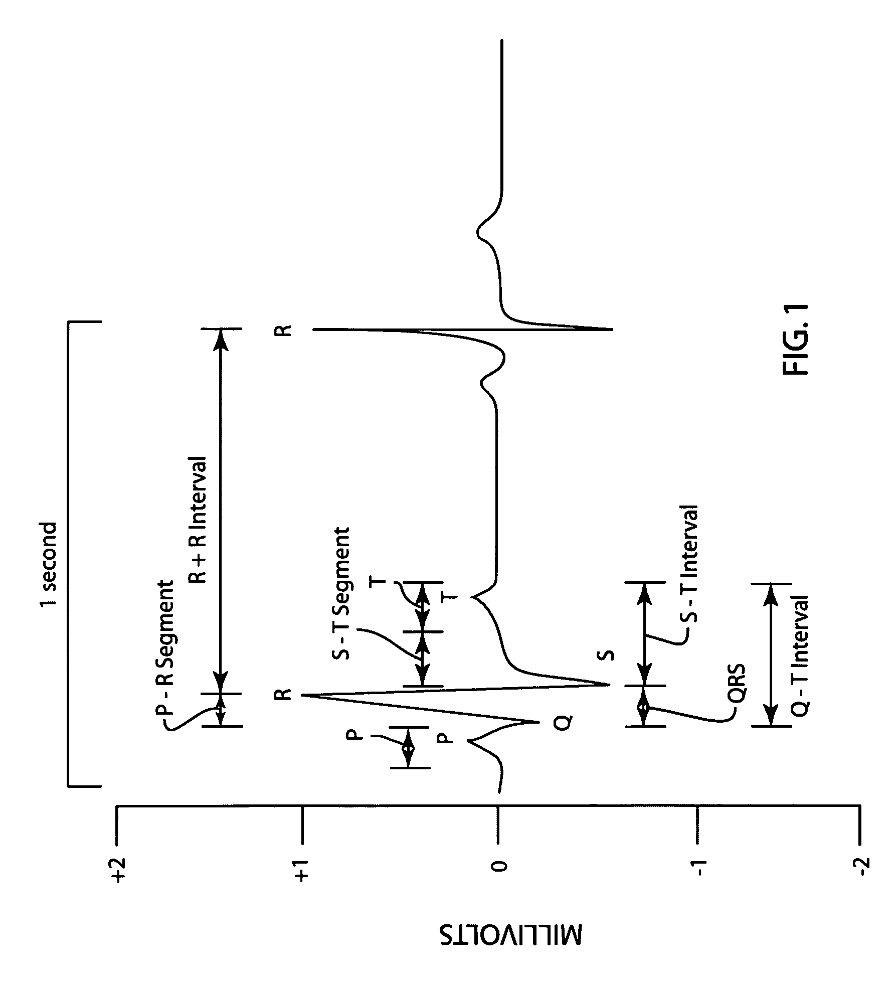 Method and apparatus for analyzing and editing ECG morphology and time series