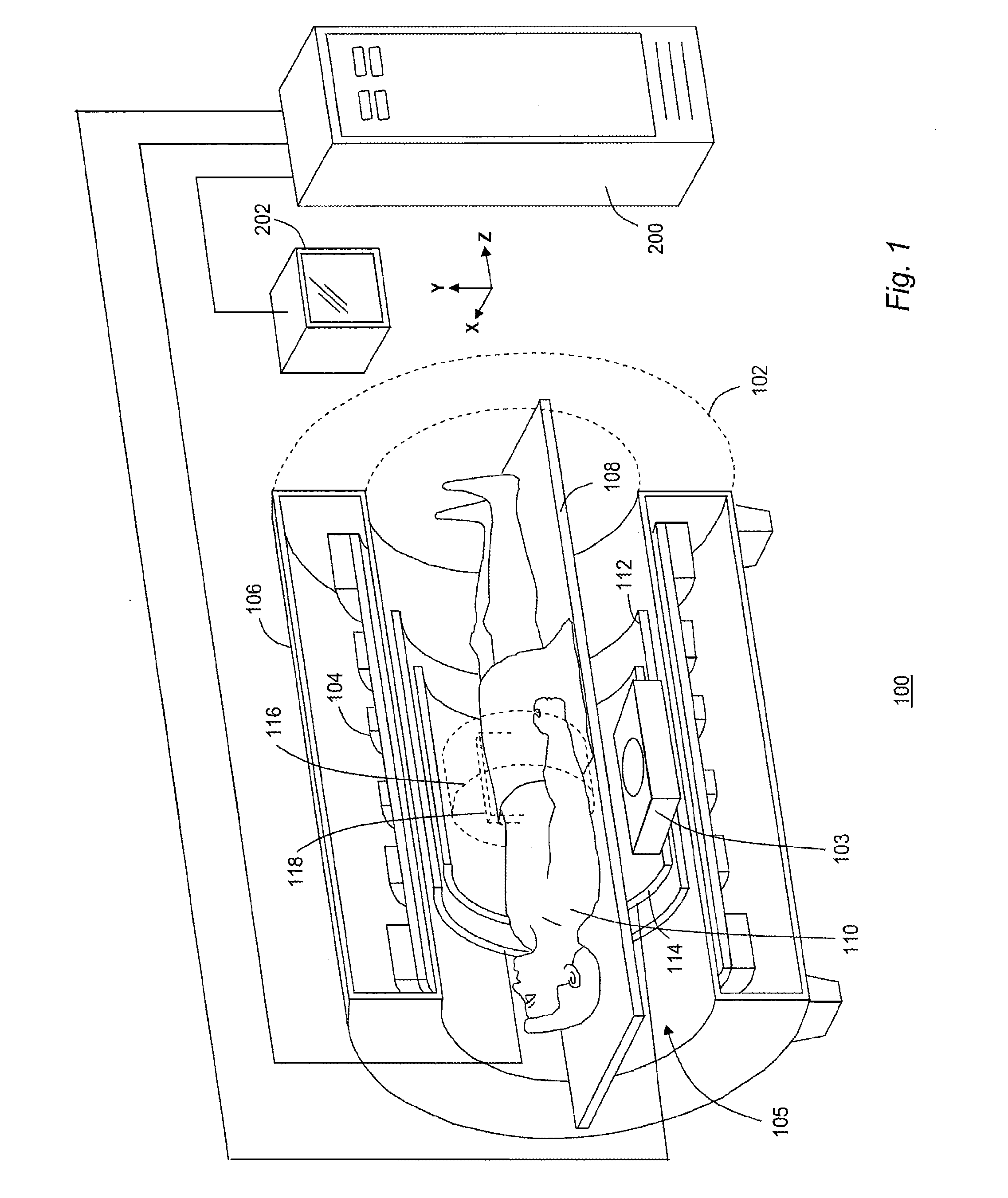 Systems and Methods for Debulking Visceral Fat