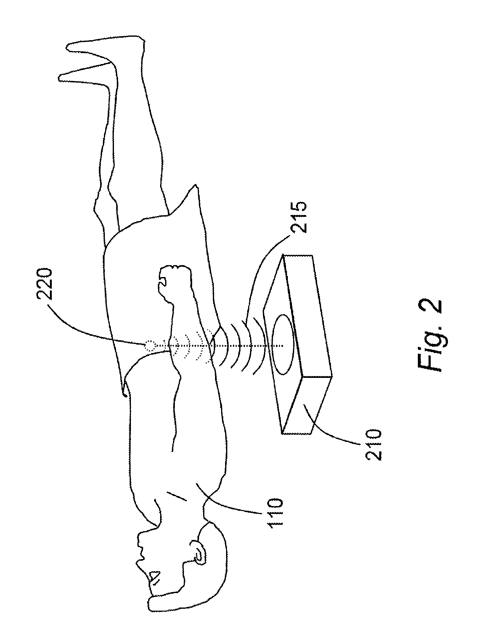 Systems and Methods for Debulking Visceral Fat