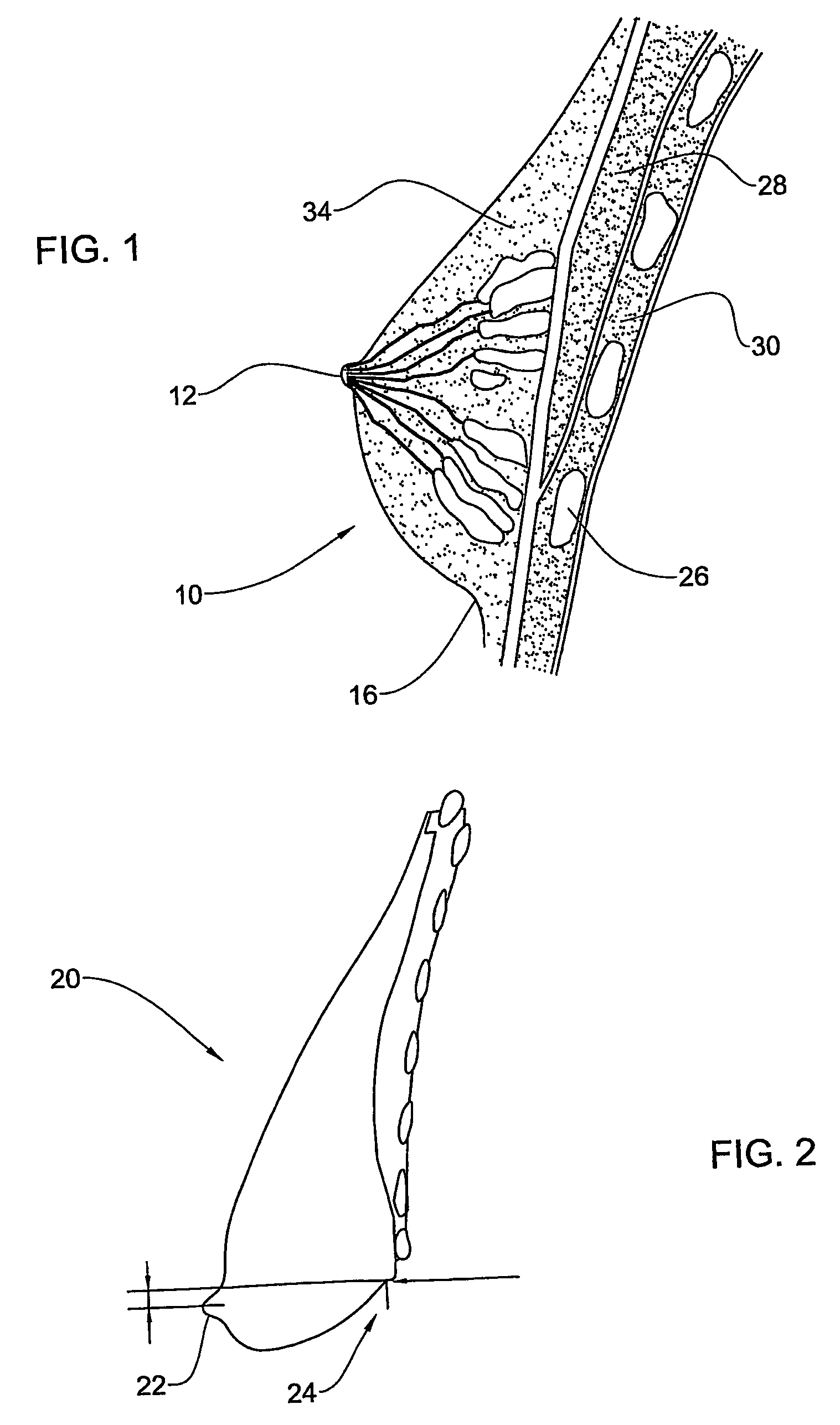 System and method for breast lifting