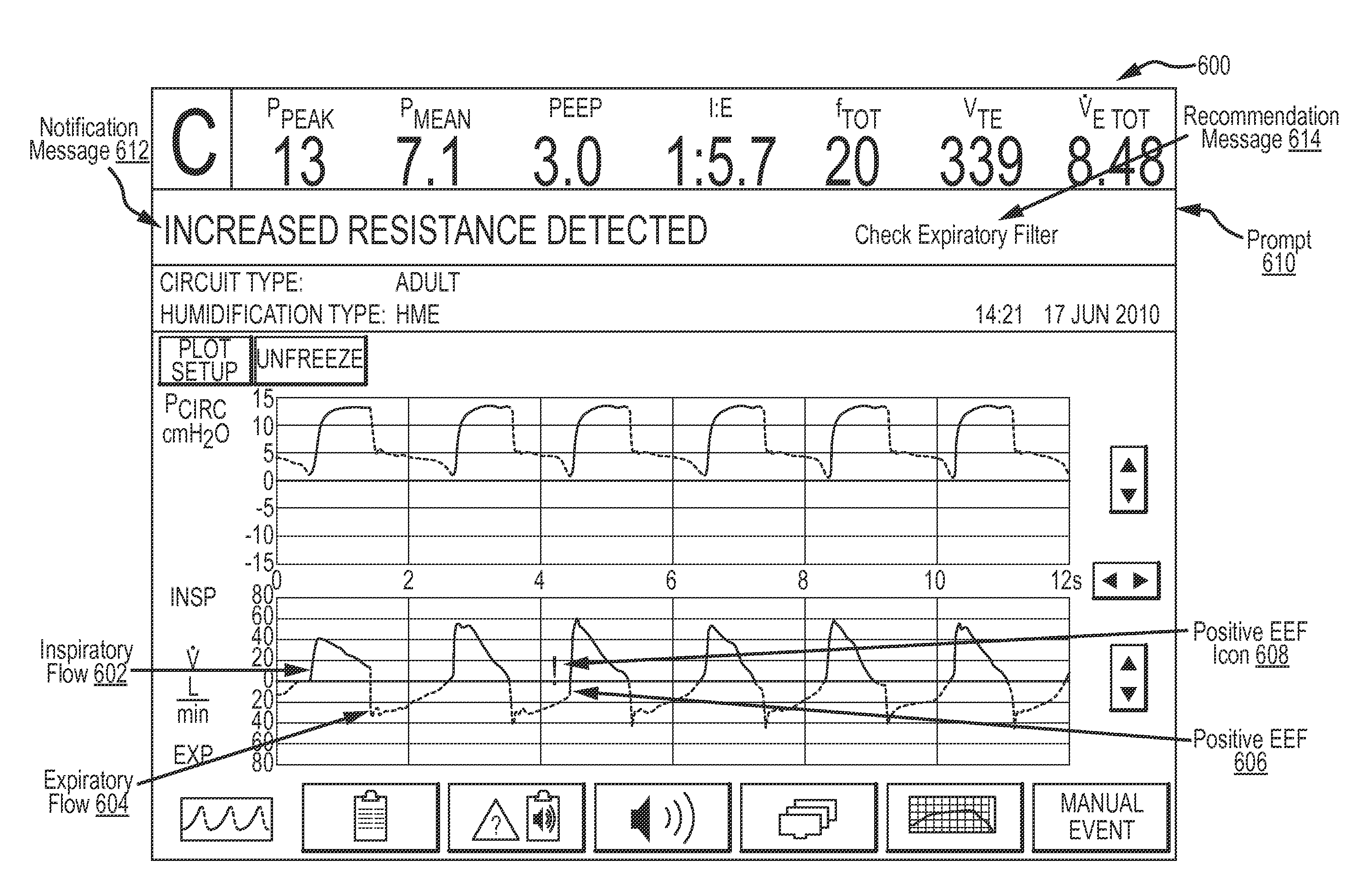 Ventilator-Initiated Prompt Regarding Detection Of Fluctuations In Resistance