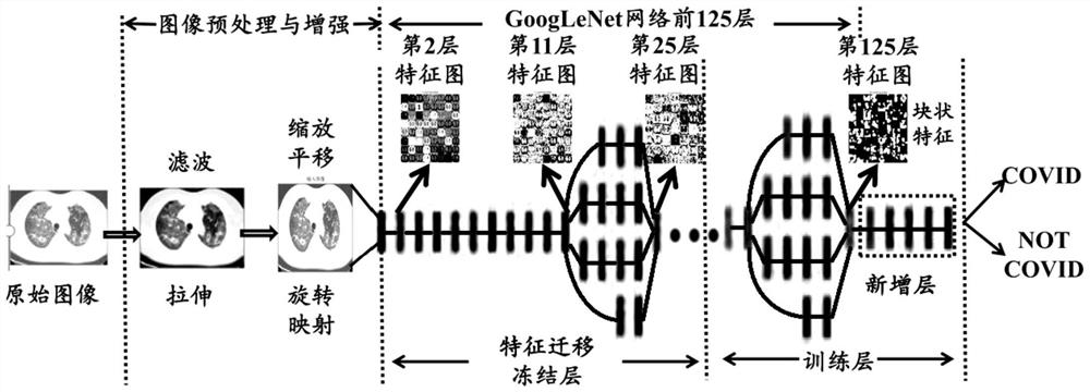 Lung CT image classification method based on feature migration