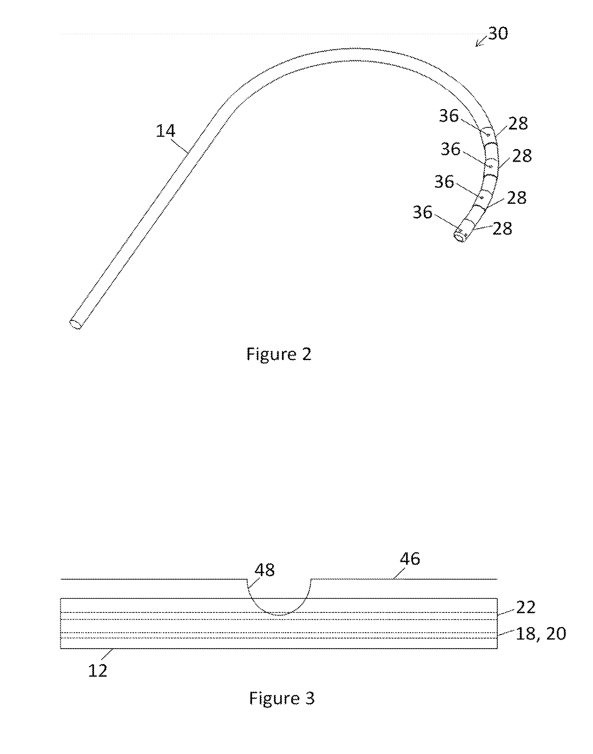 Irrigation catheter