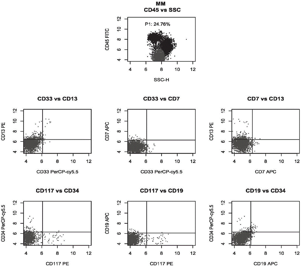 Antibody composition and its application in leukemia and lymphoma typing