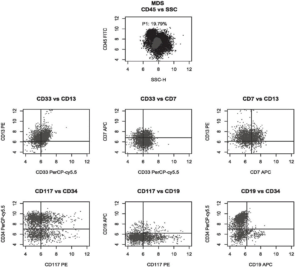 Antibody composition and its application in leukemia and lymphoma typing