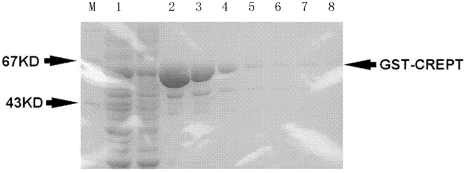 CREPT (Cell-cycle Related and Expression-elevated Protein in Tumor) antibody for identifying tumor cells or tumor tissues