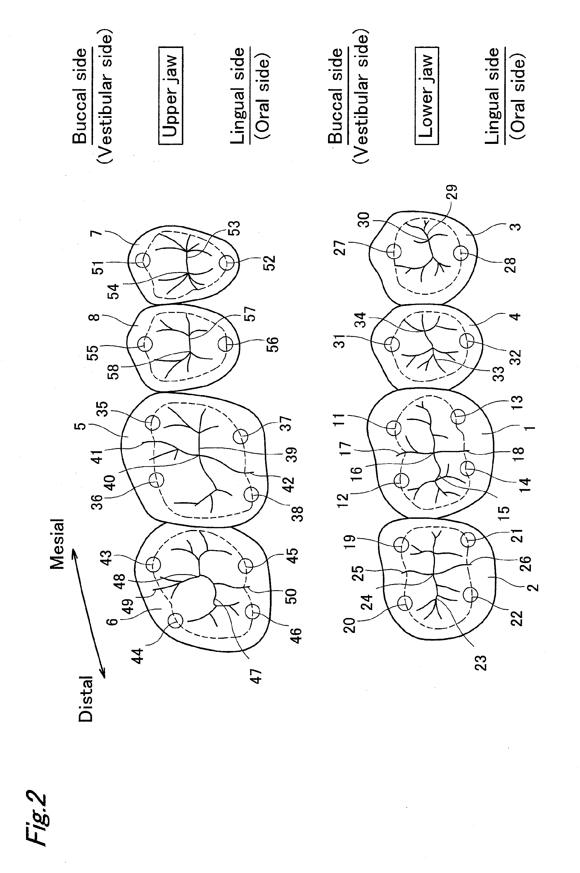 Artificial teeth