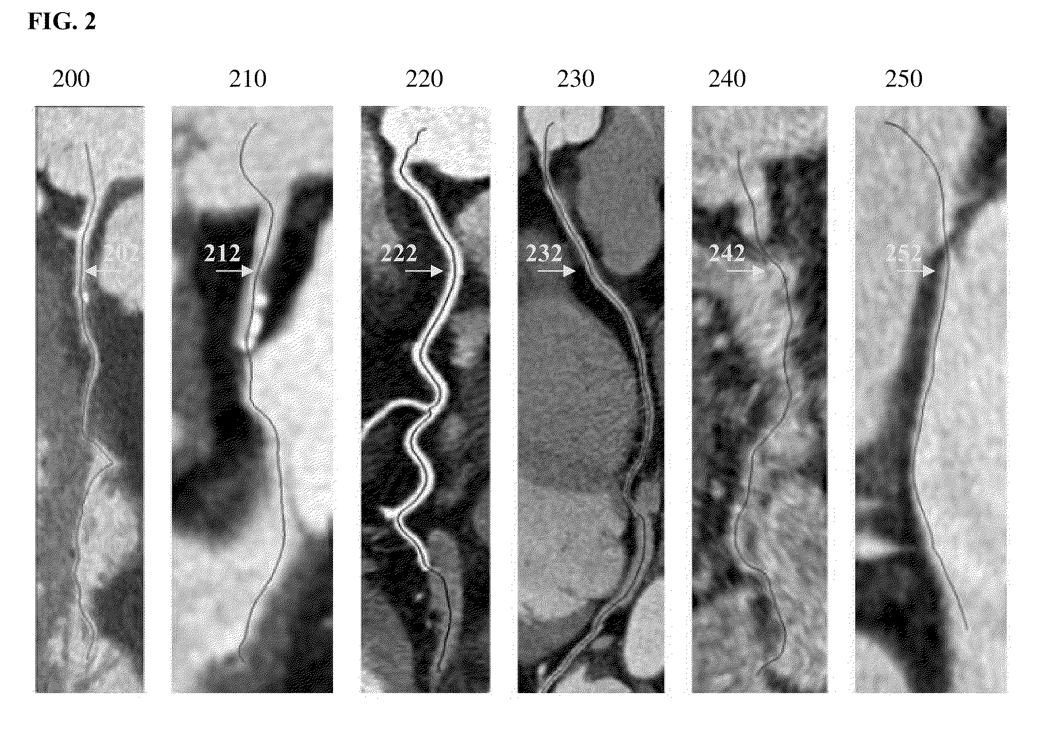 Method and system for automatic detection and classification of coronary stenoses in cardiac CT volumes