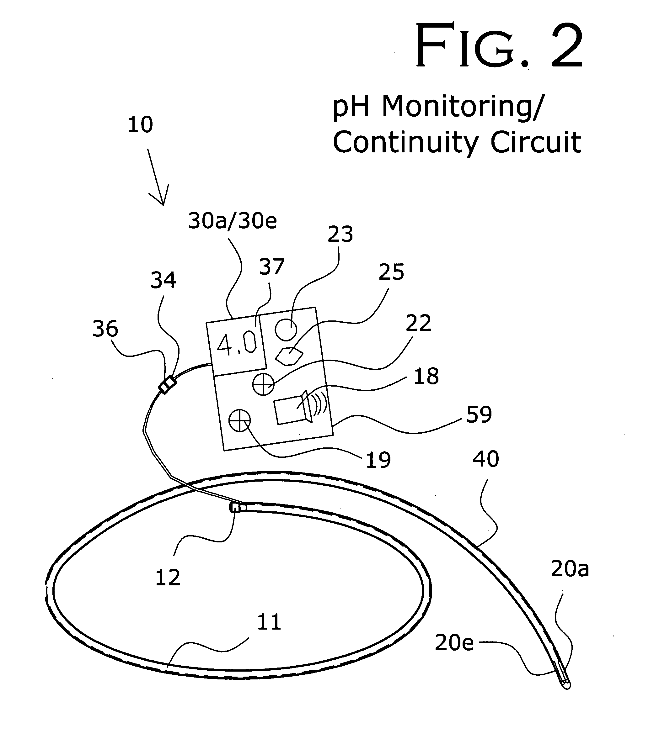 Nasogastric tube placement and monitoring system