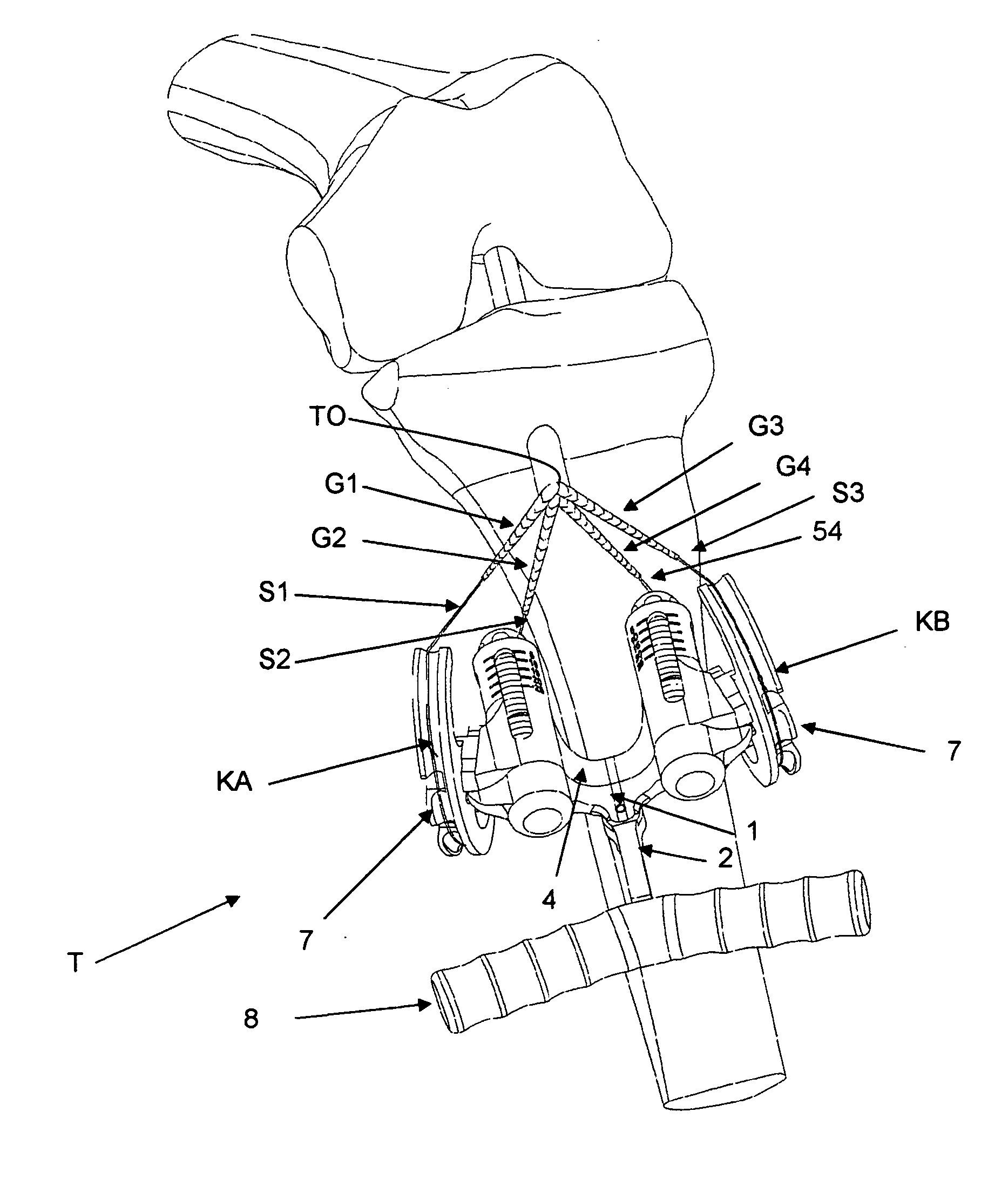 Graft ligament strand tensioner