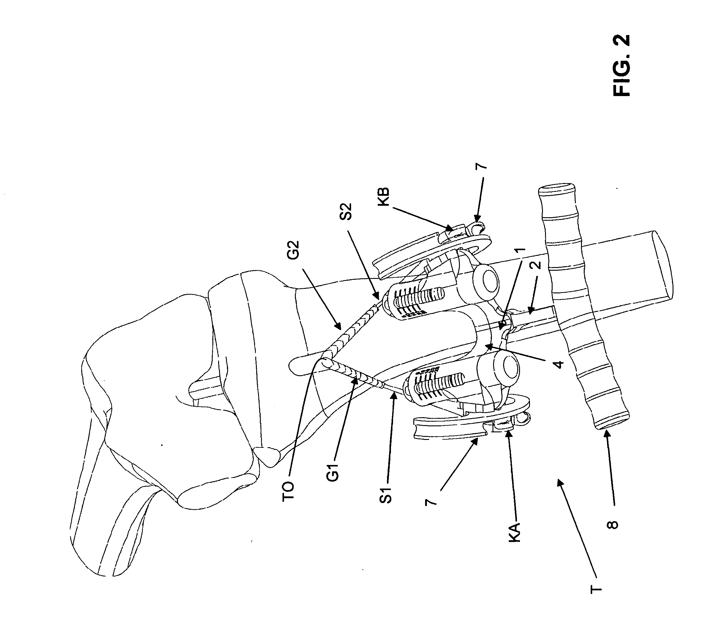 Graft ligament strand tensioner