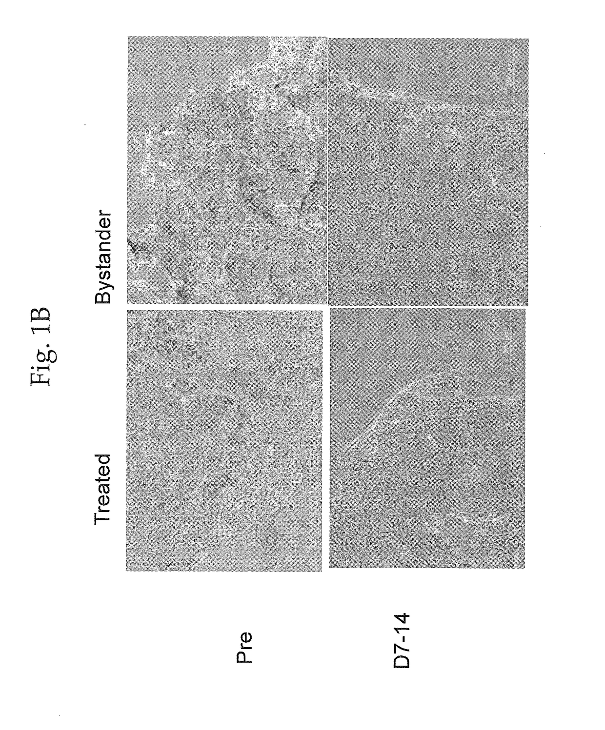 Method of Ex Vivo Enhancement of Immune Cell Activity for Cancer Immunotherapy with a Small Molecule Ablative Compound