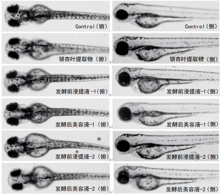 Freckle-removing and whitening traditional Chinese medicine beautifying liquid and preparation method thereof