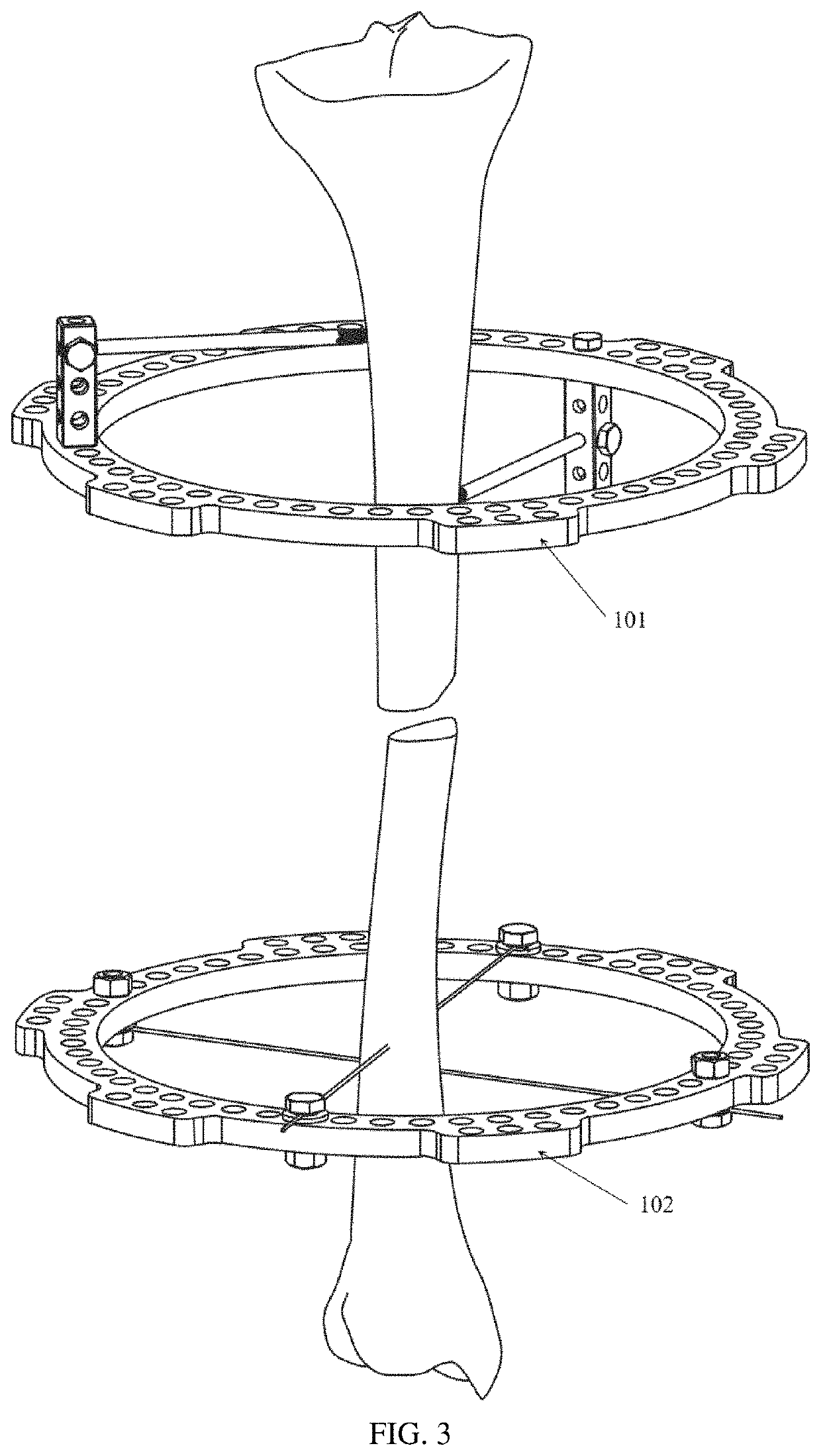 Fracture reduction method and parallel external fixator for fracture reduction