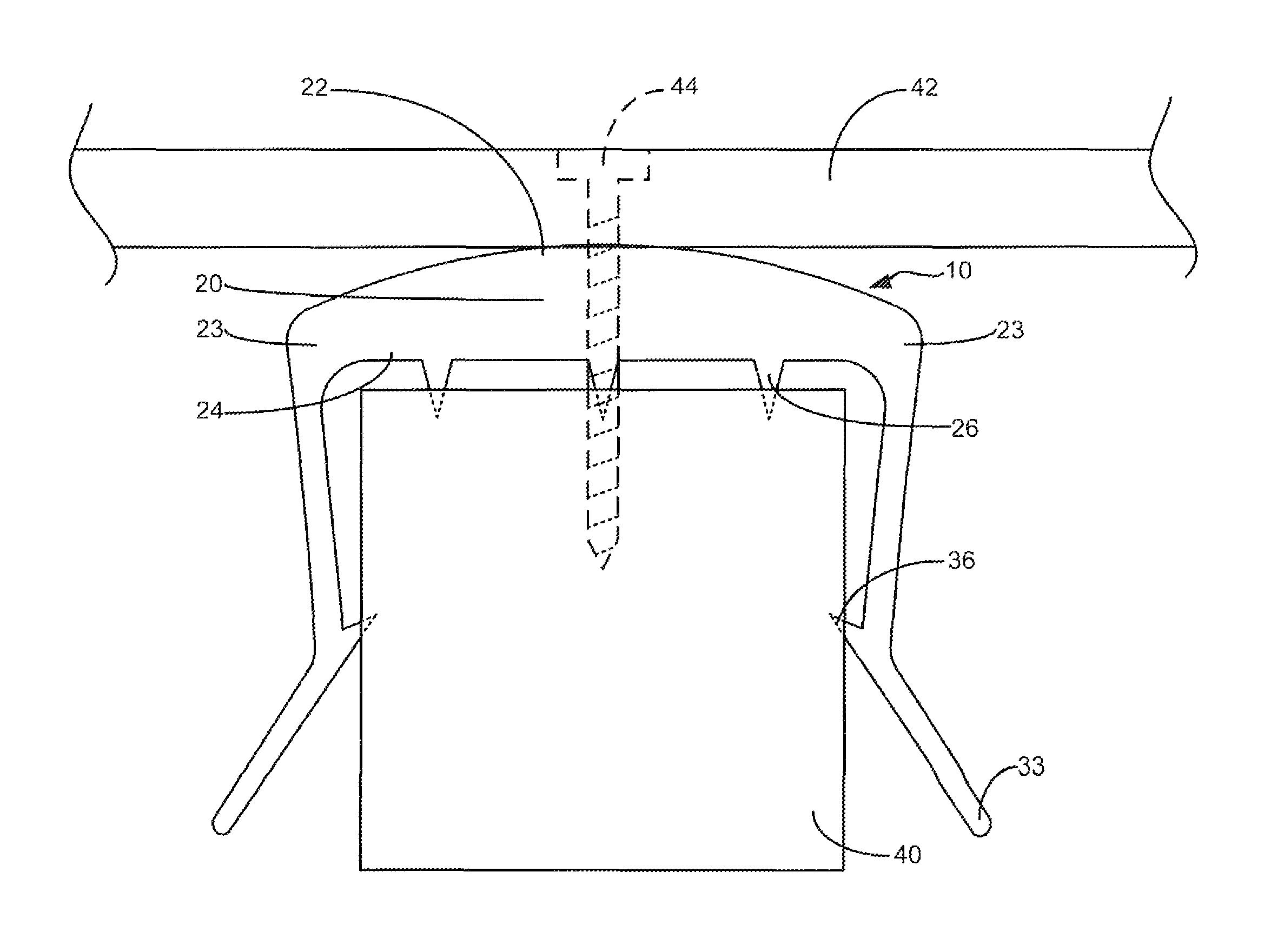 Shielding device and associated methods