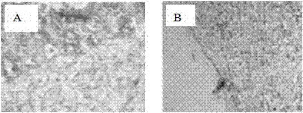 Preparation method of accellular amniotic membrane for skin biological stents of tissue engineering