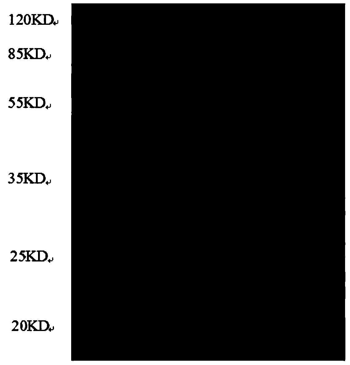 Recombinant neutrophil gelatinase associated lipocalin and preparation method of protein antibody