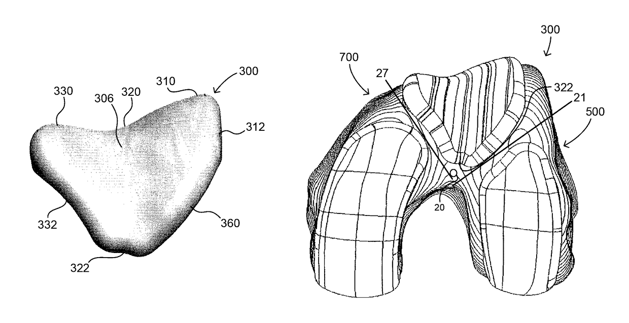 Extended patellofemoral