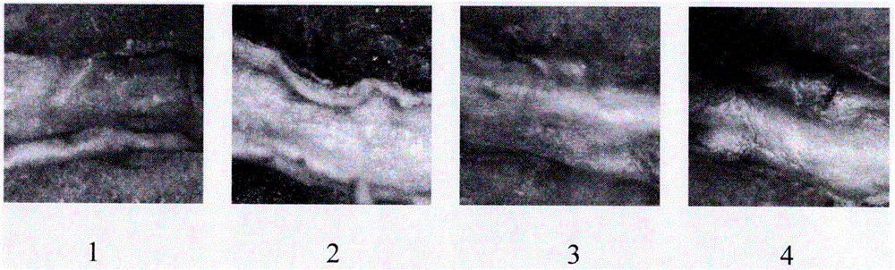 Pharmaceutical composition for treating atherosclerosis and application of pharmaceutical composition