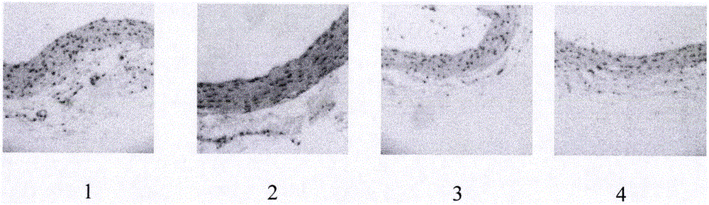 Pharmaceutical composition for treating atherosclerosis and application of pharmaceutical composition