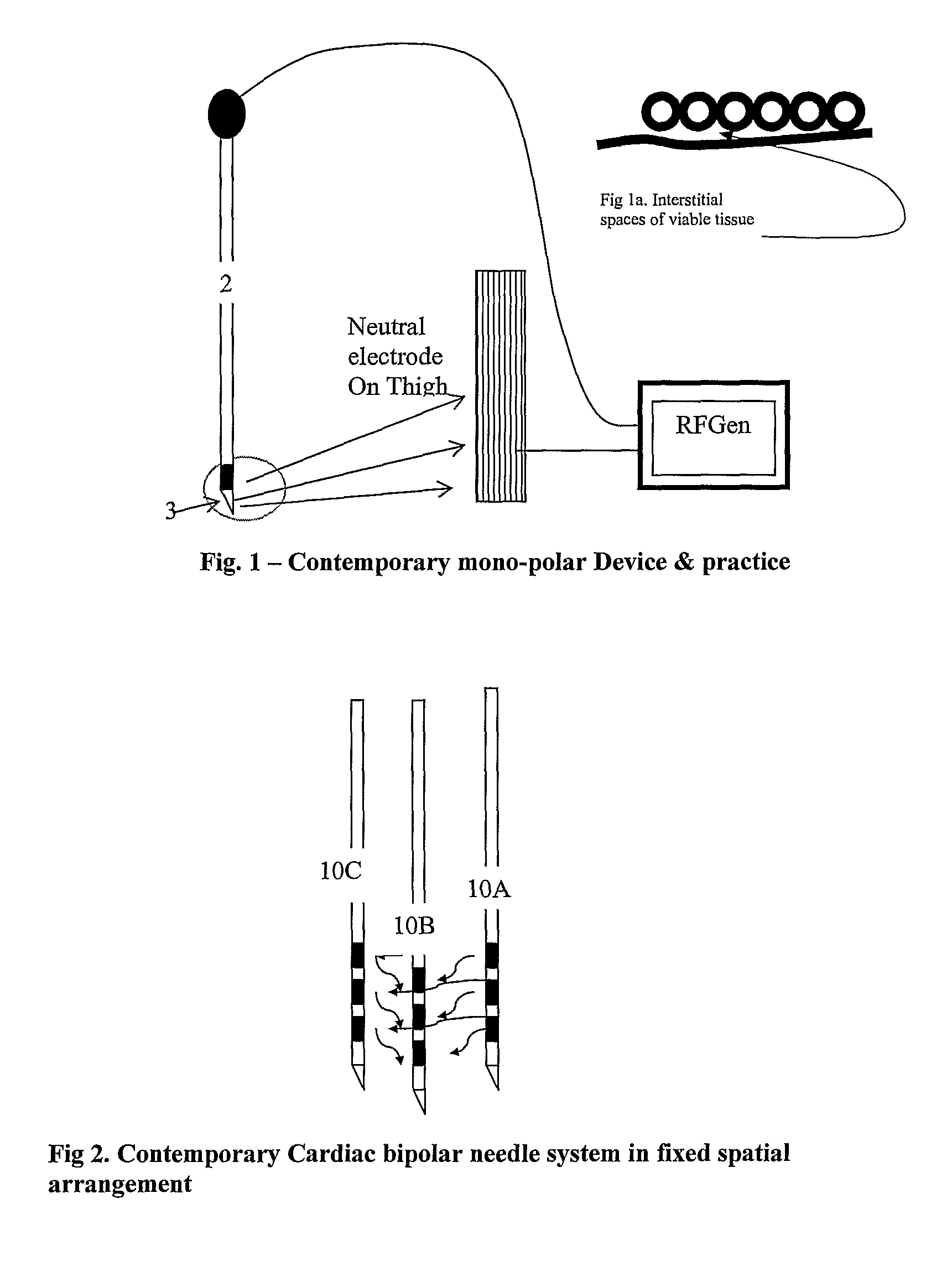 Minimal device and method for effecting hyperthermia derived anesthesia