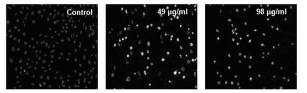 Preparation method of compound alisol A and application thereof causing renal toxicity