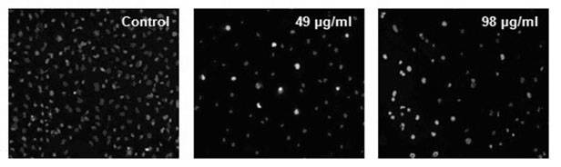 Preparation method of compound alisol A and application thereof causing renal toxicity