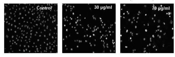 Preparation method of compound alisol A and application thereof causing renal toxicity