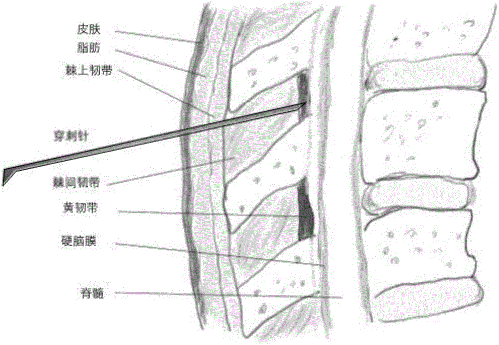 Lumbar puncture virtual simulation and training system supporting haptic interaction