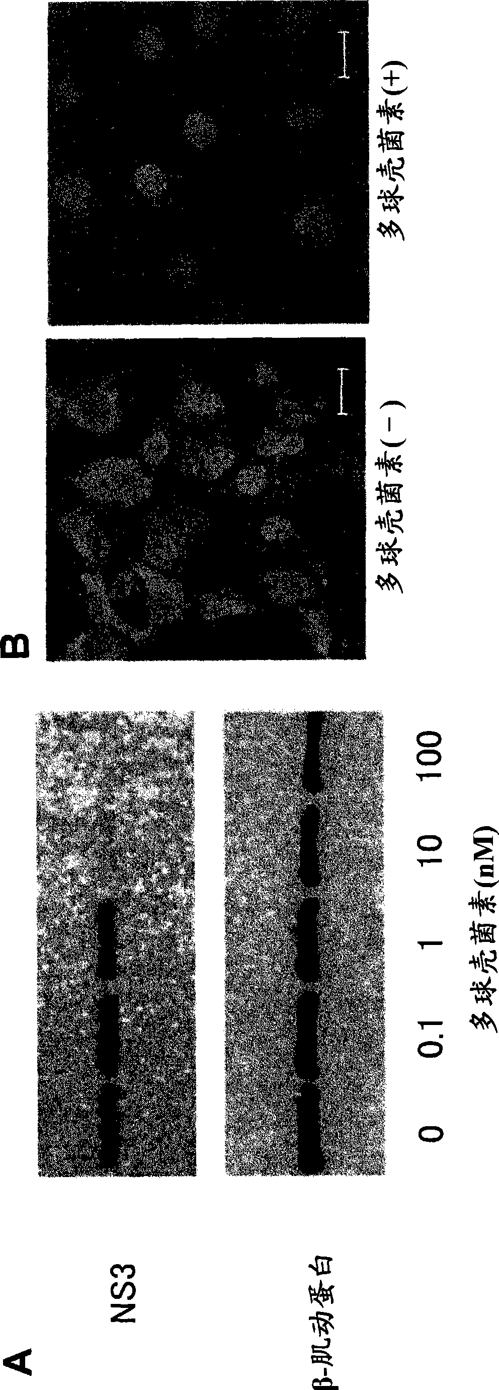 Pharmaceutical composition for treating or preventing hcv infection