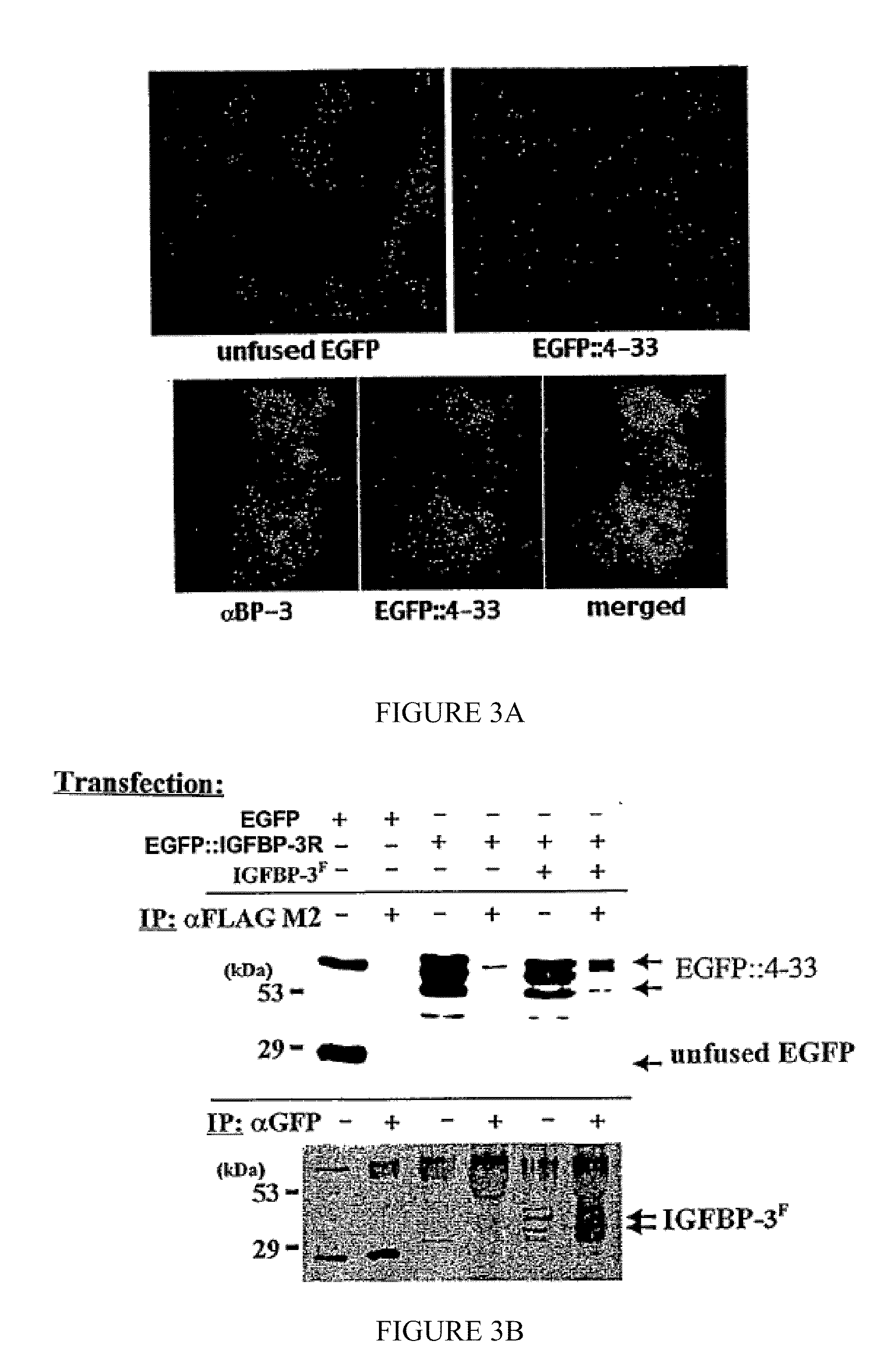 Induction of apoptosis and cell growth inhibition by protein 4.33