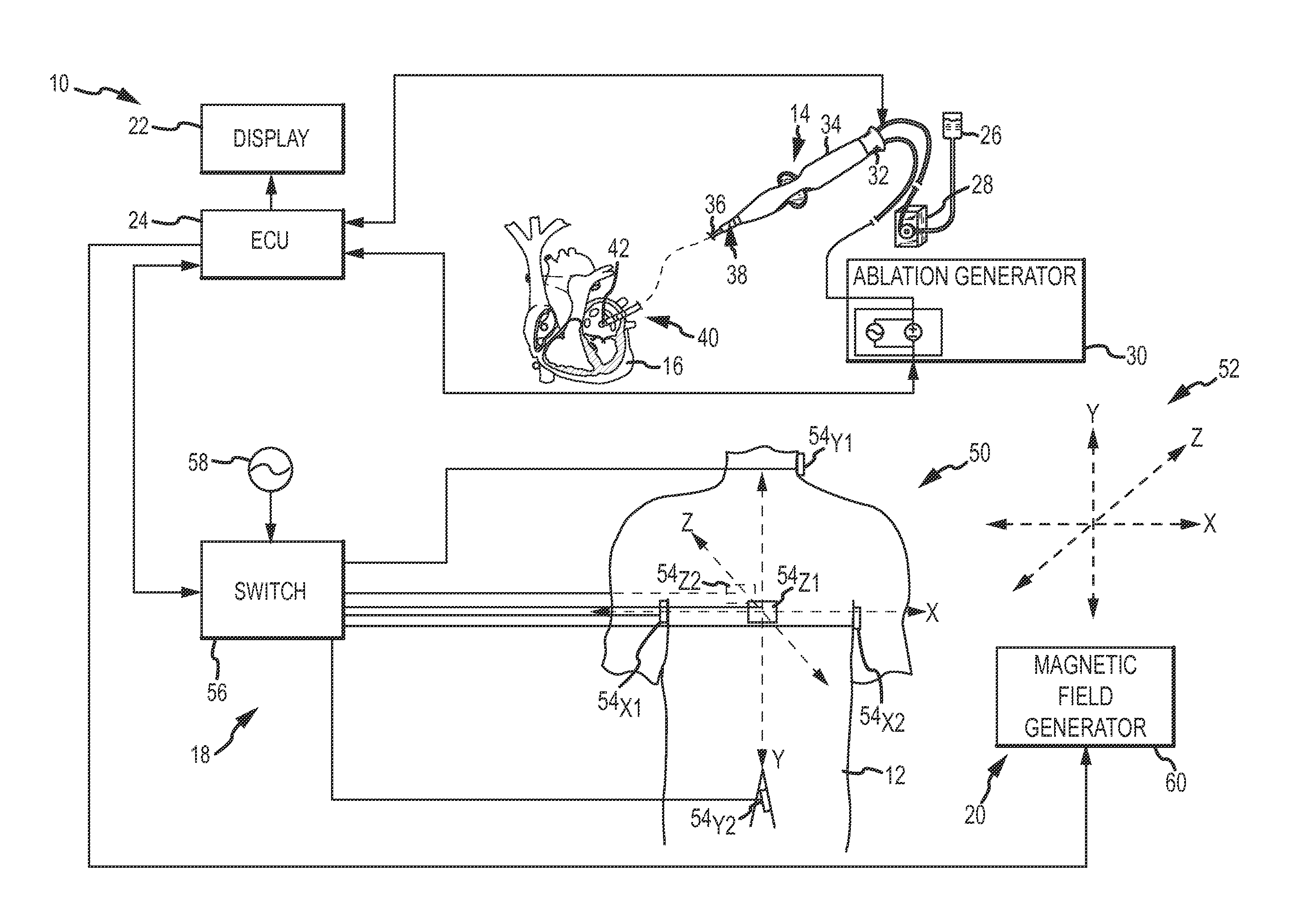 Device, system, and method for intracardiac diagnosis or therapy with localization