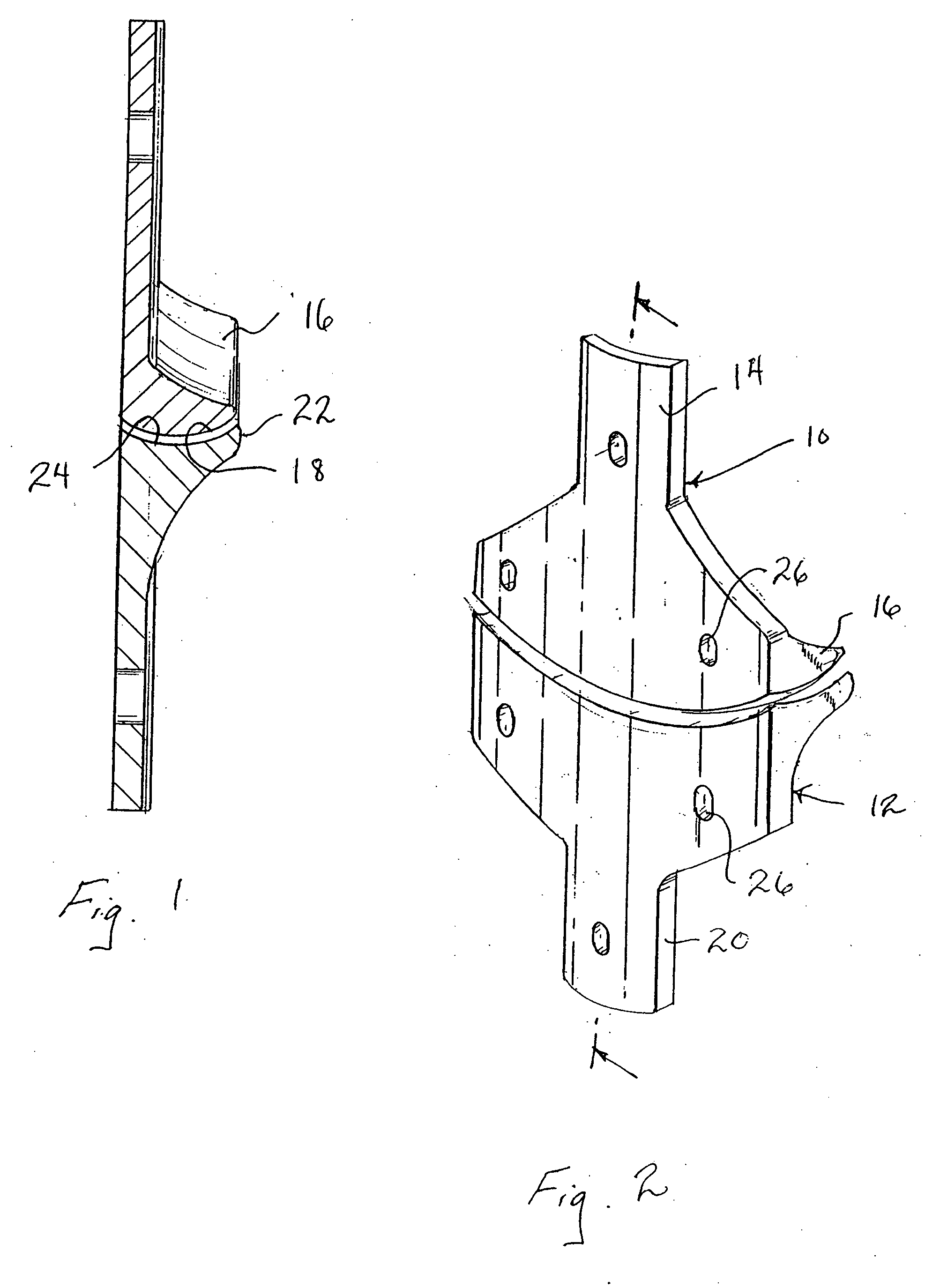 Internal brace for distraction arthroplasty