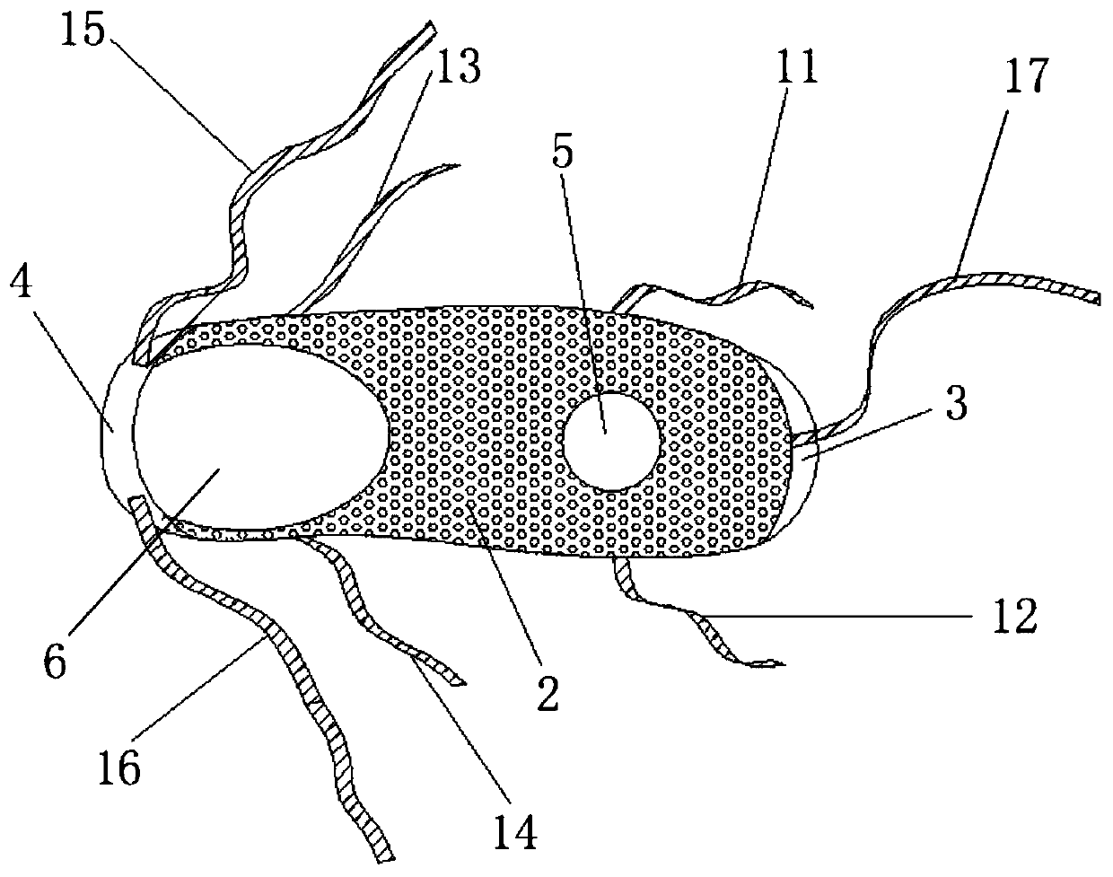 Traditional Chinese medicine insole for treating calcaneodynia