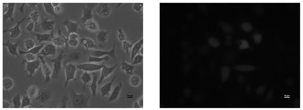 Application of macrophages in obesity treatment and blood sugar regulation