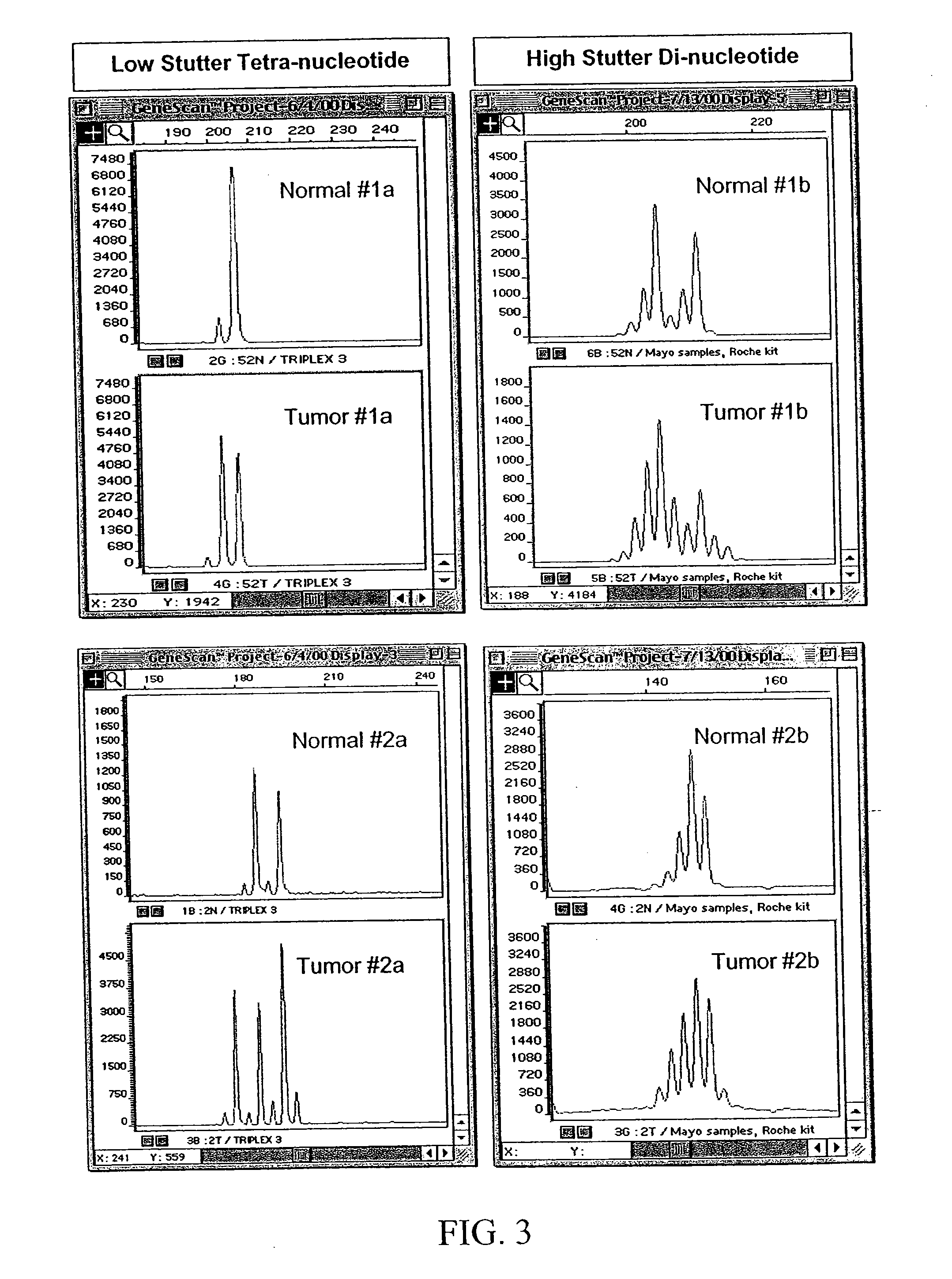 Detection of microsatellite instability and its use in diagnosis of tumors