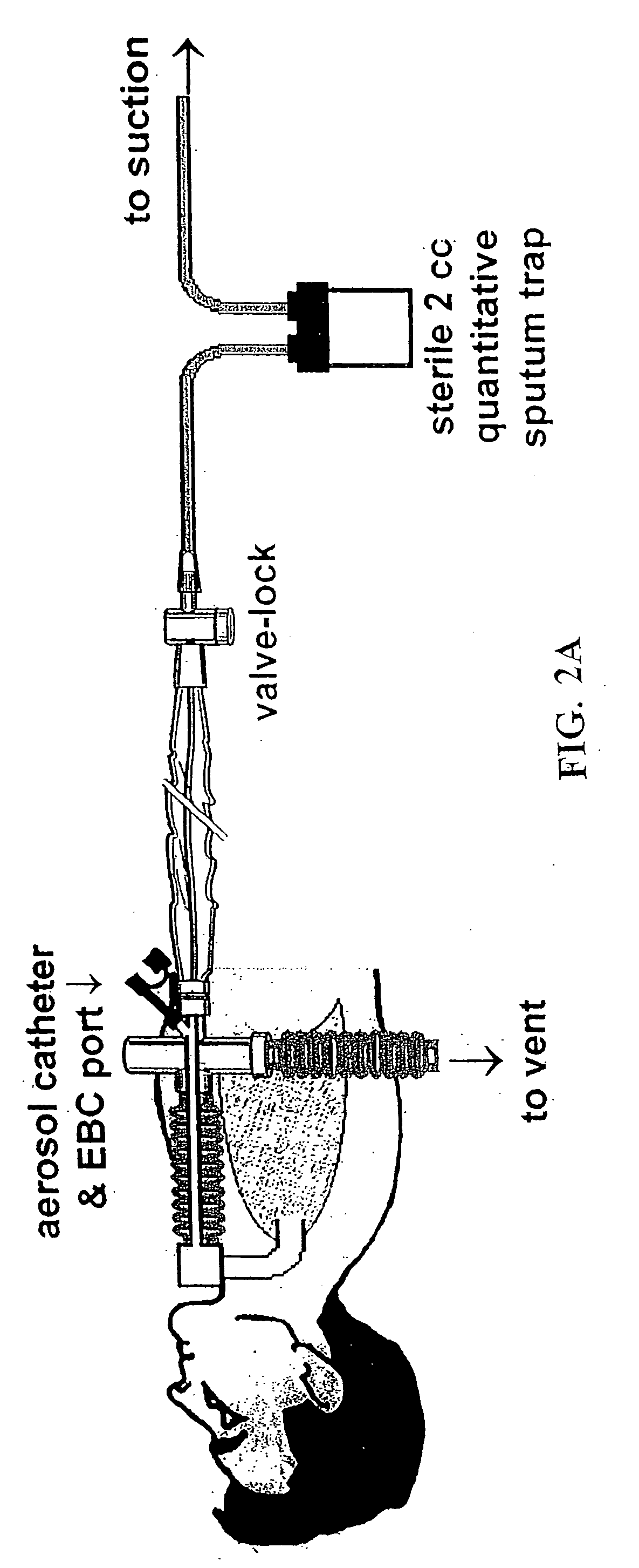 Methods, devices and formulations for targeted endobronchial therapy