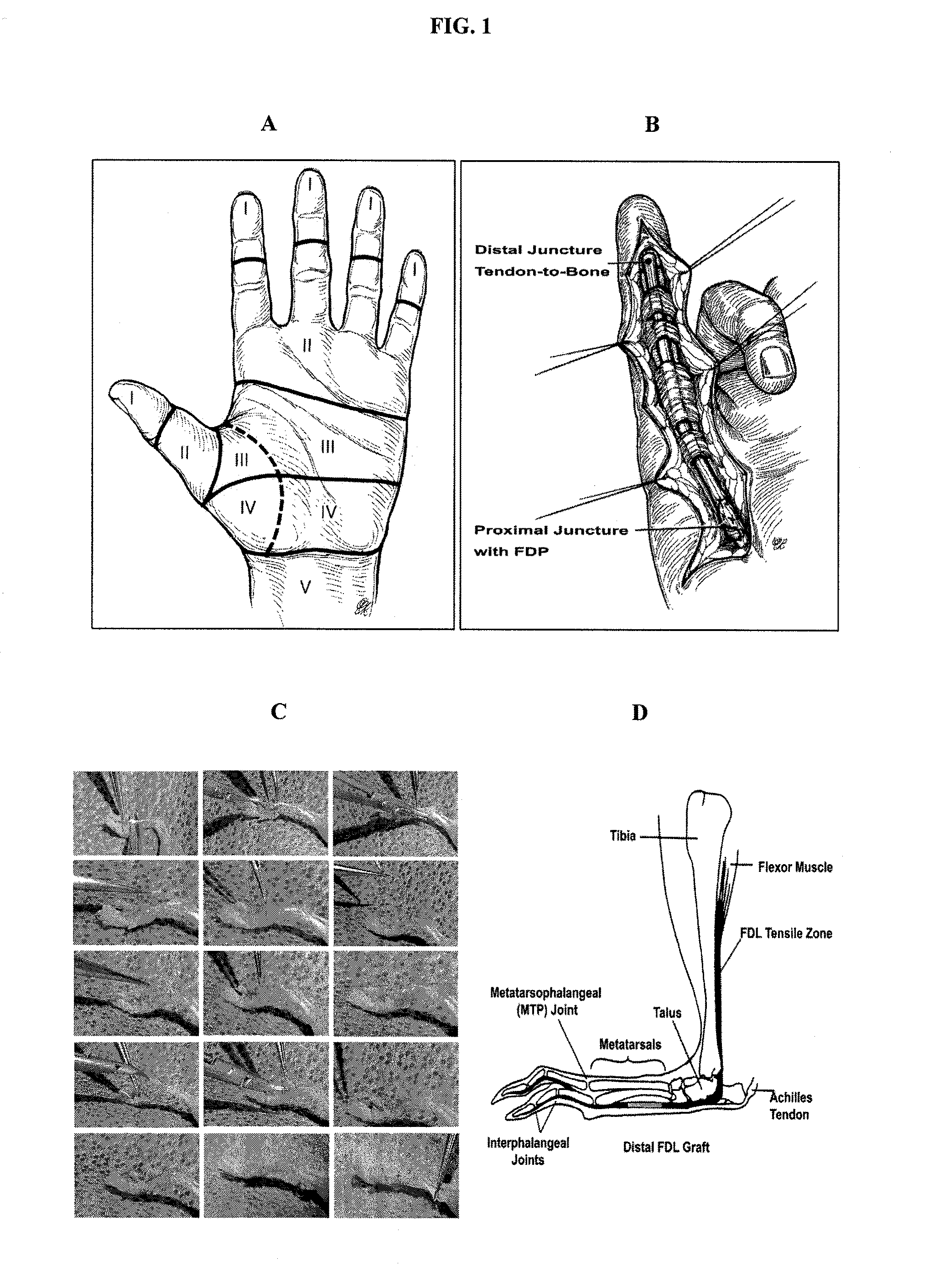 Targeted delivery of therapeutic agents with lyophilized matrices